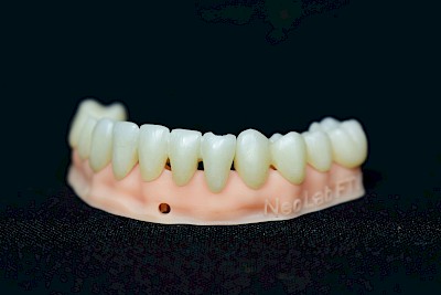 Image from the gallery